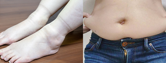 むくんだ足とたるんだお腹のイメージ